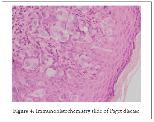 Immunohistochemistry